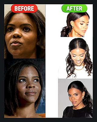 am I crazy or has Candace Owens gone under the knife?'