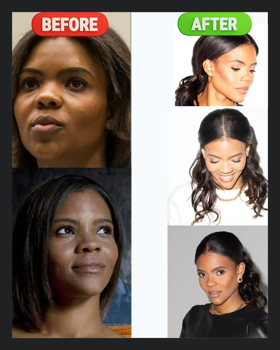 am I crazy or has Candace Owens gone under the knife? picture 1 of 1