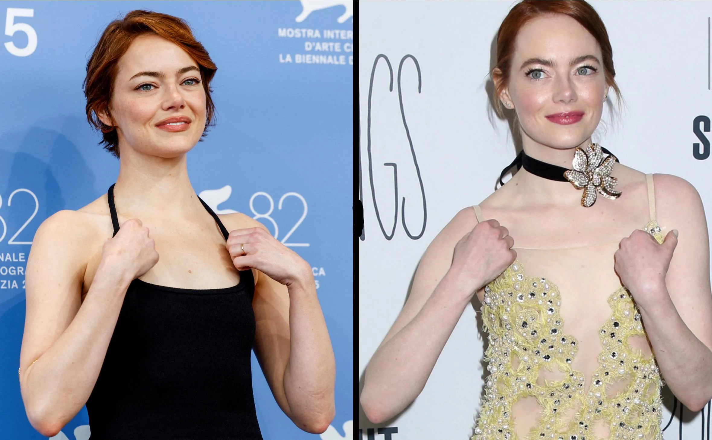 Is it me or does Emma stone looks more toned now? picture 1 of 1