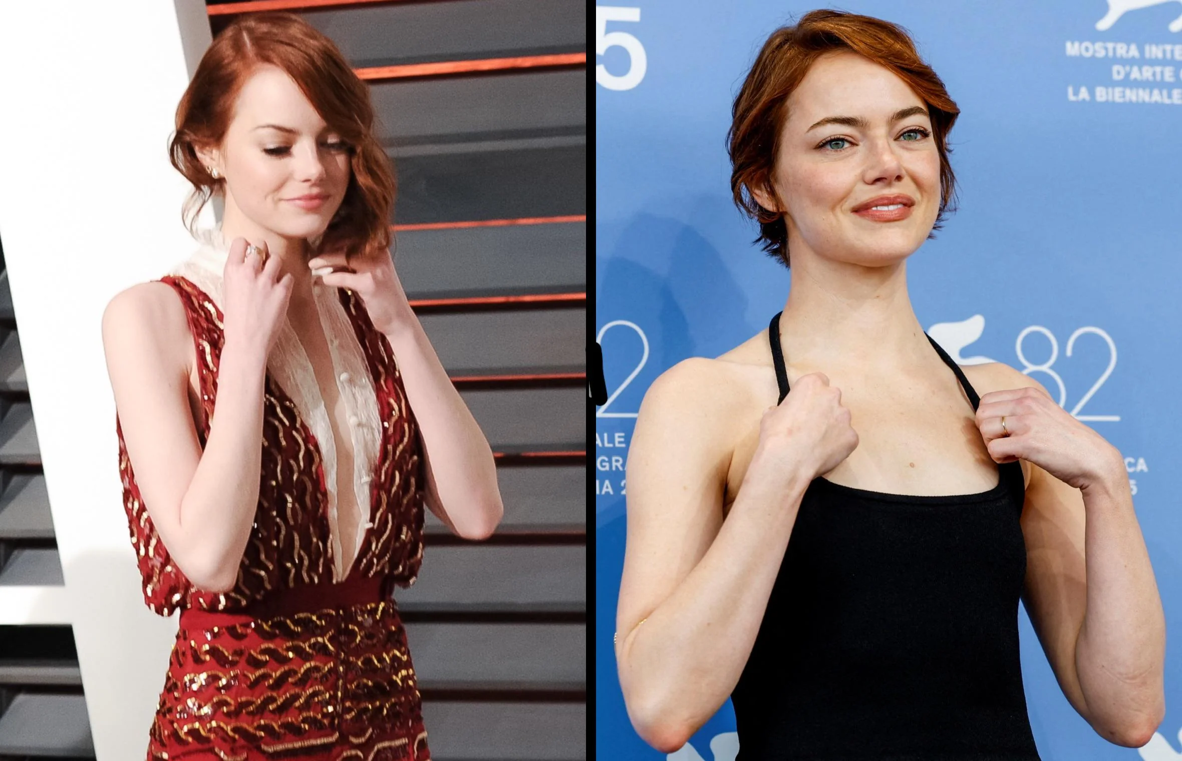 Emma stone before and after 10 years picture 1 of 1